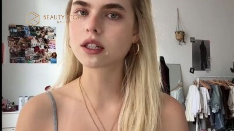 Điều trị mặt rỗ