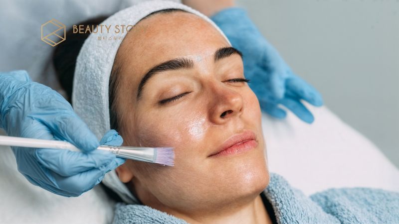 Điều trị mặt rỗ