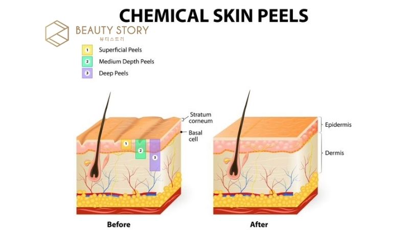 sưng - đỏ - ngứa - rát - bong da